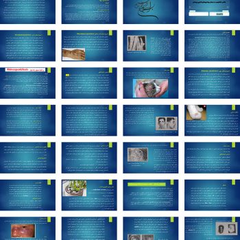 پاورپوینت علائم، تشخیص و درمان بیماری‌های قارچی پوستی